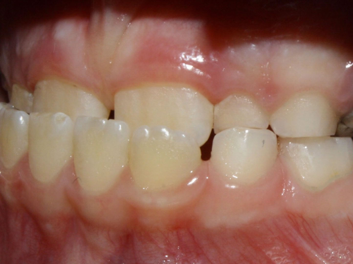 Before