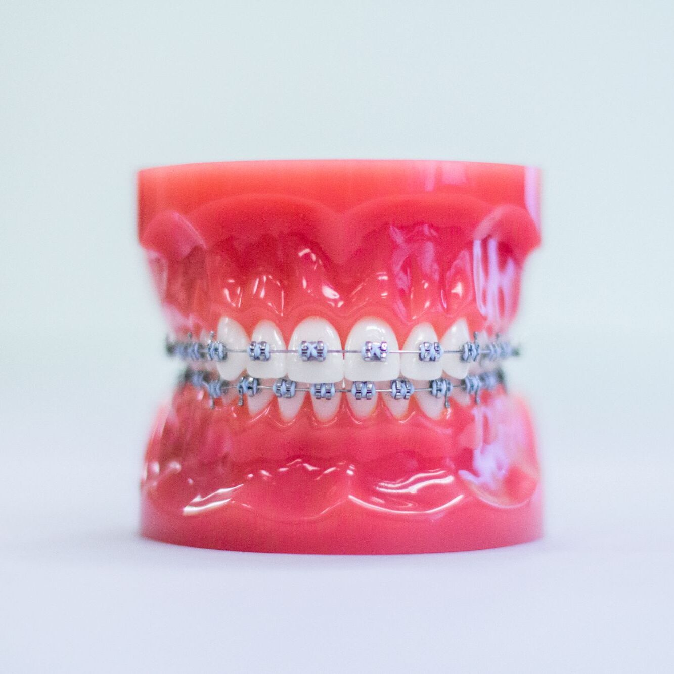 orthodontist chesterfield mo
